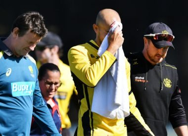 Ashton Agar sustains ghastly injury while attempting a catch