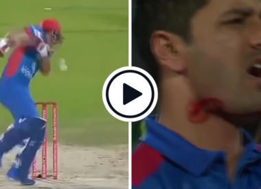 Watch: Najibullah Zadran forced to retire hurt after being hit on chin by vicious Ihsanullah bouncer