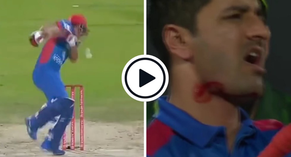 Watch: Najibullah Zadran Forced To Retire Hurt After Being Hit On Chin By Vicious Ihsanullah Bouncer
